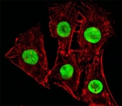 Fluorescent image of C2C12cells stained with Hmga2 antibody at 1:25 dilution. An Alexa Fluor 488-conjugated goat anti-rabbit lgG was used as the secondary Ab (green). Cytoplasmic actin was counterstained with Alexa Fluor 555 conjugated with Phalloidin (red).