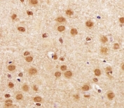 IHC analysis of FFPE mouse brain section using SIRT1 antibody at 1:25.