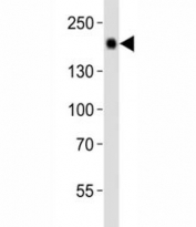 Western blot analysis of lysate from mouse liver tissue using Egfr antibody diluted at 1:1000. Expected molecular weight: ~134/170 kDa (unmodified/glycosylated).