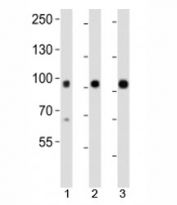 Western blot analysis of lysate from mouse 1) kidney, 2) lung and 3) skin tissue using Epha1 antibody at 1:1000.