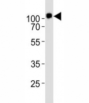 Western blot analysis of lysate from KG-1 cell line using CD34 antibody diluted at 1:1000. Expected size is 40~110 kDa depending on glycosylation level.