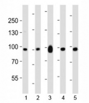 Western blot analysis of lysate from mouse 1) NIH3T3 cell line, 2) brain, 3) heart, 4) pancreas and 5) rat brain tissue lysate using Ephb1 antibody at 1:1000.