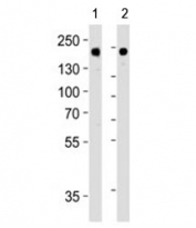 Western blot analysis of lysate from 1) MDA-MB-453 and 2) SK-BR-3 cell line using HER-2 antibody at 1:1000.