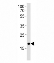 Western blot analysis of lysate from NCCIT cell line using Hmga2 antibody at 1:1000.