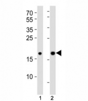 Western blot analysis of lysate from (1) human HepG2 and (2) mouse NIH3T3 cell lines using Hmga2 antibody at 1:1000. Predicted molecular weight ~12kDa but routinely observed at ~18kDa.