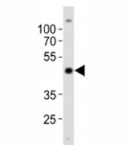 Western blot analysis of lysate from NCCIT cell line using POU5F1 antibody at 1:1000. Predicted molecular weight ~38/30kDa (isoform A/B), commonly observed at 38-45 kDa.