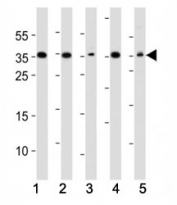 Western blot analysis of lysate from (1) A549, (2) HeLa, (3) HepG2, (4) Jurkat, (5) mouse NIH3T3 cell line using DKK1 antibody. Predicted molecular weight: 26-40 kDa depending on glycosylation level.