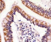 IHC testing of FFPE human colon with ABL2 antibody at 1:25. HIER: steam sections in pH6 citrate buffer.