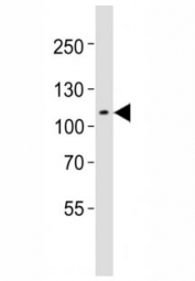 Western blot testing of Mertk antibody at 1:1000 dilution + mouse spleen lysate; Predicted molecular weight: 110~205 kDa depending on glycosylation level