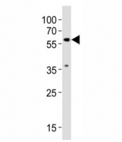Western blot testing of SMAD2 antibody at 1:1000 dilution + NIH3T3 lysate; Predicted molecular weight: 52~60 kDa.