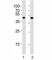 Western blot testing of Pou5f1 antibody at 1:4000 dilution. Lane 1: F9 lysate; 2: NCCIT lysate; Predicted molecular weight ~38/30kDa (isoform A/B), commonly observed at 38-45 kDa.