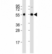 Western blot testing of Beclin-1 antibody at 1:2000 dilution. Lane 1: Zebrafish lysate; 2: ZF4 lysate; Predicted band size : 51 kDa.