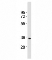 Western blot testing of NANOG antibody at 1:2000 dilution + human brain lysate; Predicted molecular weight: 35-45 kDa.