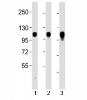 Western blot testing of Integrin alpha 7 antibody at 1:2000 dilution. Lane 1: HeLa lysate; 2: Jurkat lysate; 3: Raji lysate