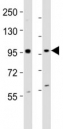 Western blot testing of EZH2 antibody at 1:2000 dilution. Lane 1: mouse F9 lysate; 2: human K562 lysate; Predicted band size : 95 kDa.