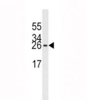 EIF4E antibody western blot analysis in Jurkat lysate. Predicted molecular weight ~27 kDa.