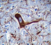 MAP2 antibody immunohistochemistry analysis in formalin fixed and paraffin embedded human brain tissue.