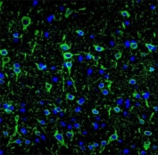 Confocal immunofluorescent analysis of MAP2 antibody with brain tissue followed by Alexa Fluor 488-conjugated goat anti-mouse lgG (green). DAPI was used as a nuclear counterstain (blue).
