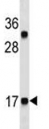 CGRP antibody western blot analysis in HL-60 lysate