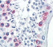 IHC analysis of FFPE human testis tissue stained with EZH2 antibody