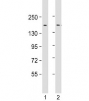Western blot testing of human 1) HeLa and 2) SW480 cell lysate with LAP2 antibody at 1:1000. Predicted molecular weight: 158 kDa.
