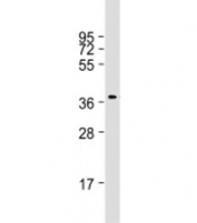 Western blot testing of human Raji cell lysate with RASSF2 antibody at 1:1000. Predicted molecular weight: 38 kDa.