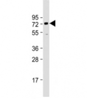 Western blot testing of human HeLa cell lysate with BANP antibody at 1:1000. Predicted molecular weight: 56 kDa, observed here at ~70 kDa.