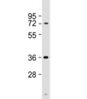 Western blot testing of human brain lysate with NMNAT1 antibody at 1:1000. Predicted molecular weight: 32 kDa, commonly observed at 28-36 kDa.