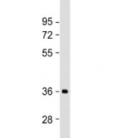 Western blot testing of human brain lysate with NMNAT1 antibody at 1:2000. Predicted molecular weight: 32 kDa, commonly observed at 28-36 kDa.