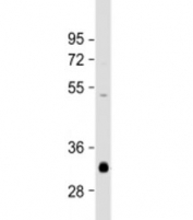 Western blot testing of human brain lysate with NMNAT1 antibody at 1:2000. Predicted molecular weight: 32 kDa, commonly observed at 28-36 kDa.