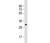 Western blot testing of human SK-OV-3 cell lysate with IGFBP5 antibody at 1:2000. Predicted molecular weight: 31 kDa.
