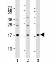 Western blot testing of human 1) A549, 2) HeLa and 3) spleen lysate with PLA2 antibody at 1:2000. Predicted molecular weight: 16 kDa.