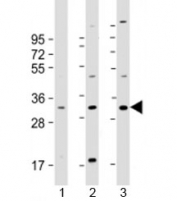 Western blot testing of human 1) U-2OS, 2) U-251 MG and 3) A431 cell lysate with FAM125A antibody at 1:2000. Predicted molecular weight: 29 kDa.