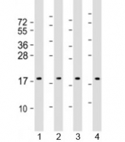 Western blot testing of human 1) HepG2, 2) HeLa, 3) Caki-1 and 4) HT-29 cell lysate with ARF4 antibody at 1:2000. Predicted molecular weight: 21 kDa.