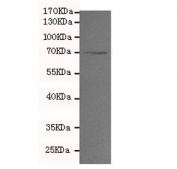 Western blot testing of mouse Raw264.7 cell lysate with MMP2 antibody at 1:200. Expected molecular weight: ~72 kDa (pro form), ~63 kDa (cleaved form).