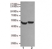 Western blot testing of 1) rat brain and 2) mouse brain lysates using NSE antibody at 1:500. Predicted molecular weight ~47 kDa.