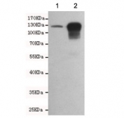 Western blot testing of 1) mouse embryo and 2) human HCT116 cell lysates using E-Cadherin antibody. Expected molecular weight: 135 kDa (precursor), 80-120 kDa (mature, depending on glycosylation level).