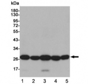 Western blot testing of human 1) HeLa, 2) THP-1, 3) A549, 4) Ramos and 5) K562 cell lysates using SOD2 antibody at 1:1000. Predicted molecular weight ~25 kDa.