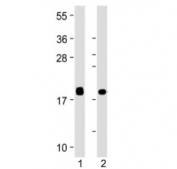 Western blot testing of VILIP1 antibody at 1:4000: Lane 1) human brain and 2) human cerebellum lysate. Predicted molecular weight ~22 kDa.