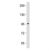 Western blot testing of SSH3 antibody at 1:2000 + ZR-75-1 cell lysate. Predicted molecular weight ~73 kDa, can be observed at 90-95 kDa.