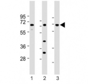 Western blot testing of LAT2 antibody at 1:1000: Lane 1) human brain, 2) kidney and 3) liver lysate. Predicted molecular weight ~58 kDa.