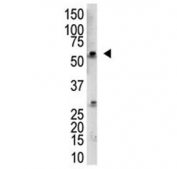 Western blot testing of mouse kidney tissue lysate with RBCK1 antibody at 1:1000 dilution. Predicted molecular weight ~58 kDa.