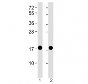 Western blot testing of 1) human brain and 2) mouse brain lysate with SNCA antibody at 1:2000. Predicted molecular weight ~15 kDa.