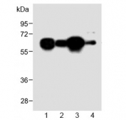 Western blot testing of human 1) HL60, 2) A431, 3) Jurkat and 4) mouse NIH3T3 cell lysate with METTL14 antibody at 1:2000. Expected molecular weight: 52-65 kDa.