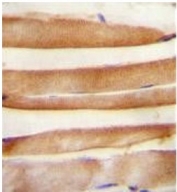 IHC staining of FFPE human skeletal muscle with ARV1 antibody. HIER: boil tissue sections in pH6, 10mM citrate buffer, for 20 min and allow to cool before testing.