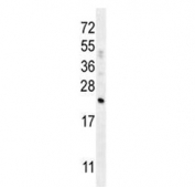 Western blot testing of human A549 cell lysate with Complement Factor D antibody. Predicted molecular weight: ~27 kDa.
