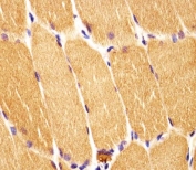 IHC testing of FFPE human skeletal muscle tissue with Dishevelled antibody. HIER: steam section in pH6 citrate buffer for 20 min and allow to cool prior to staining.