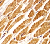 IHC testing of FFPE human heart tissue with PCCA antibody. HIER: steam section in pH6 citrate buffer for 20 min and allow to cool prior to staining.