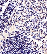 IHC testing of FFPE human thymus tissue with TERT antibody. HIER: steam section in pH6 citrate buffer for 20 min and allow to cool prior to staining.