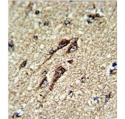 IHC testing of FFPE human brain tissue with ATP5B antibody. HIER: steam section in pH6 citrate buffer for 20 min and allow to cool prior to staining.